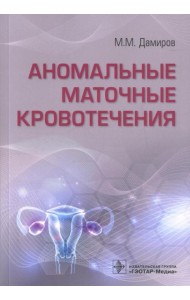 Аномальные маточные кровотечения