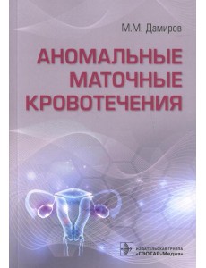 Аномальные маточные кровотечения