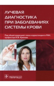 Лучевая диагностика при заболеваниях системы крови