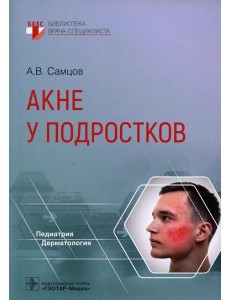 Акне у подростков
