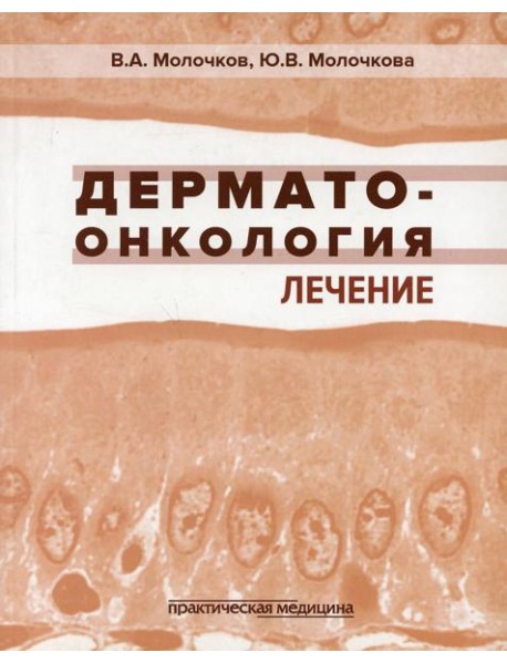 Дерматоонкология. Лечение