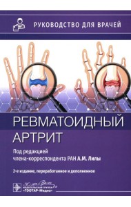 Ревматоидный артрит: руководство для врачей. 2-е изд., перераб. и доп