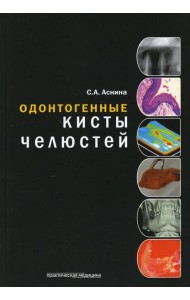 Одонтогенные кисты челюстей
