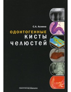 Одонтогенные кисты челюстей