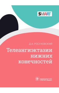 Телеангиэктазии нижних конечностей