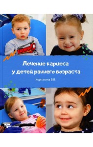 Лечение кариеса у детей раннего возраста