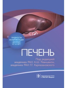 Трудности интерпретации данных КТ и МРТ: печень