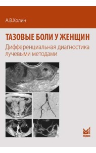 Тазовые боли у женщин. Дифференцианальная диагностика лучевыми методами