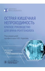 Острая кишечная непроходимость. Краткое руководство для врача-рентгенолога