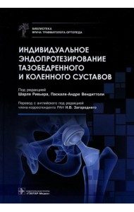 Индивидуальное эндопротезирование тазобедренного и коленного суставов