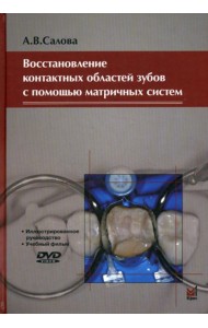 Восстановление контактных областей зубов с помощью матричных систем. 2-е изд., + CD