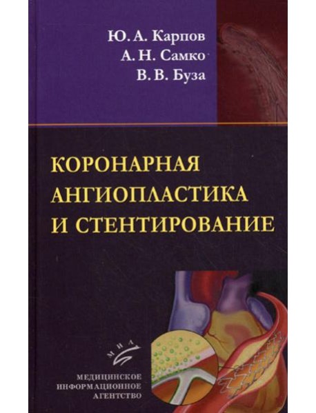 Коронарная ангиопластика и стентирование