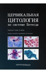 Цервикальная цитология по системе Бетесда. Терминология, критерии и пояснения