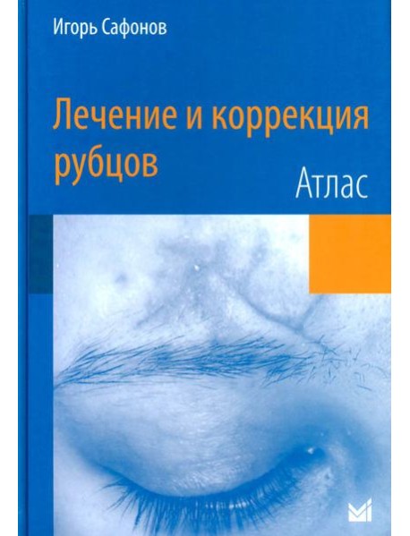 Лечение и коррекция рубцов. Атлас