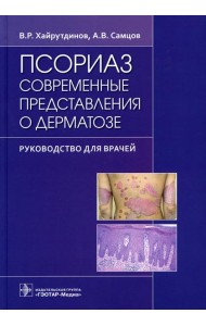 Псориаз. Современные представления о дерматозе: руководство для врачей