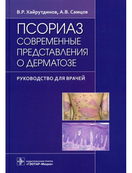 Псориаз. Современные представления о дерматозе: руководство для врачей