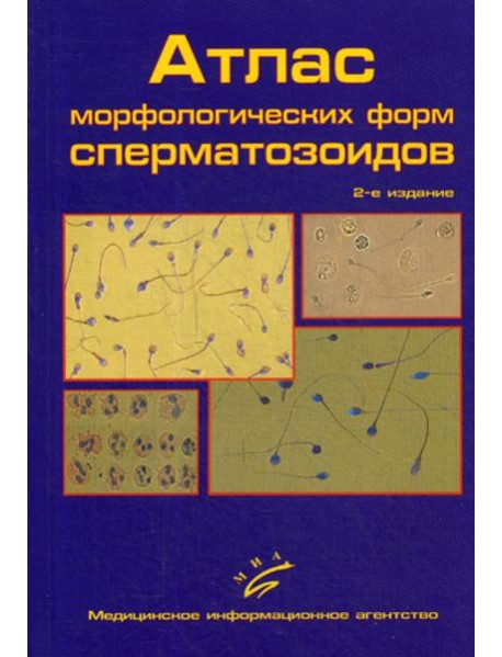 Атлас морфологических форм сперматозоидов. 2-е изд., доп