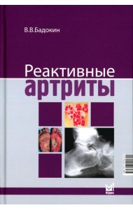 Реактивные артриты. Урогенитальные и постэнтероколитические. 2-е изд