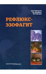 Рефлюкс-эзофагит