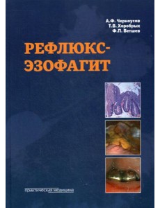 Рефлюкс-эзофагит Рефлюкс-эзофагит