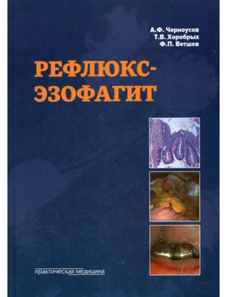 Рефлюкс-эзофагит