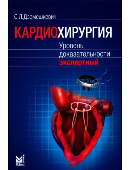 Кардиохирургия. Уровень доказательности экспертный