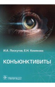 Конъюнктивиты