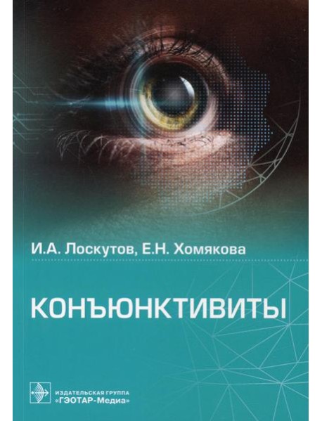 Конъюнктивиты