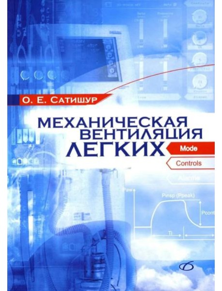 Механическая вентиляция легких