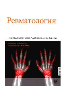 Ревматология. 2-е изд Ревматология. 2-е изд