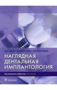 Наглядная дентальная имплантология