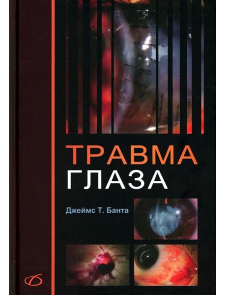 Травма глаза