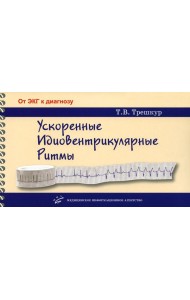 Ускоренные идиовентрикулярные ритмы: клинико-электрокардиографические особенности, систематизация по ЭКГ-характеристикам, дифференцирование с другими