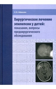 Хирургическое лечение эпилепсии у детей: показания, вопросы предхирургического обследования