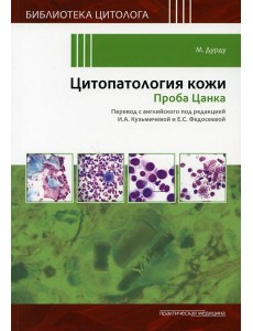 Цитопатология кожи. Проба Цанка