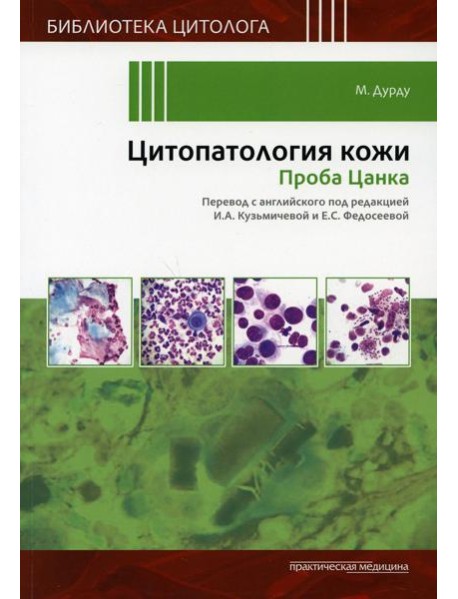 Цитопатология кожи. Проба Цанка