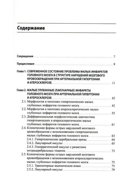 Малые инфаркты головного мозга