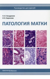 Патология матки. Руководство для врачей. 2-е изд