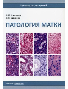 Патология матки. Руководство для врачей. 2-е изд