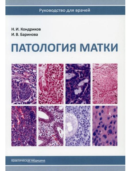 Патология матки. Руководство для врачей. 2-е изд