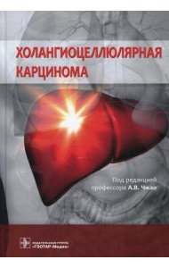 Холангиоцеллюлярная карцинома