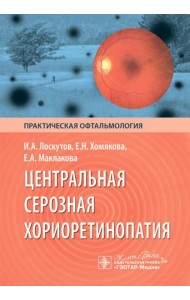 Центральная серозная хориоретинопатия