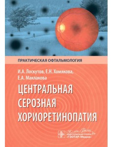 Центральная серозная хориоретинопатия Центральная серозная хориоретинопатия