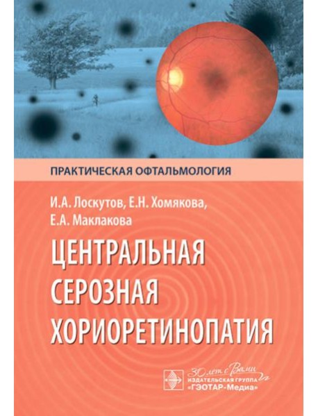 Центральная серозная хориоретинопатия