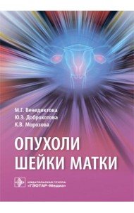 Опухоли шейки матки