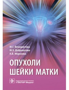 Опухоли шейки матки