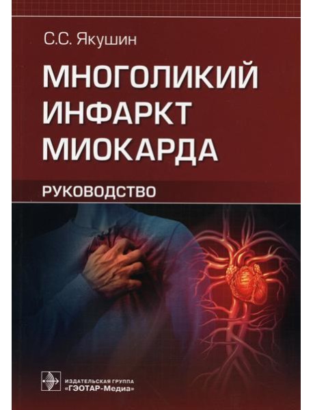 Многоликий инфаркт миокарда. Руководство
