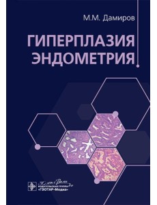 Гиперплазия эндометрия Гиперплазия эндометрия