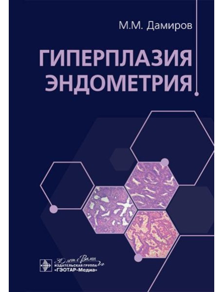 Гиперплазия эндометрия