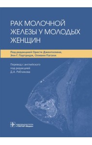 Рак молочной железы у молодых женщин